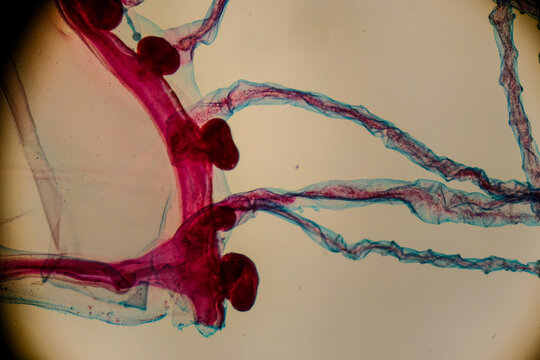 Gonionemus showing statocysts and radial canals under microscop