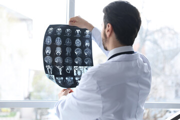 Doctor examining brain MRI scan in clinic, back view