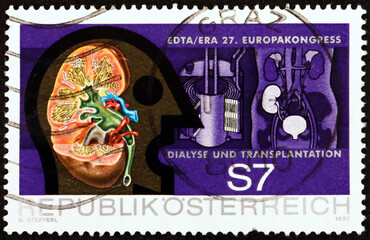 Postage stamp Austria 1990 European Dialysis and Transplantation Society, 27th Congress