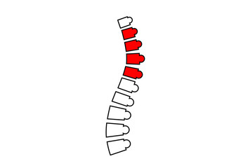 Scoliosis medical poster