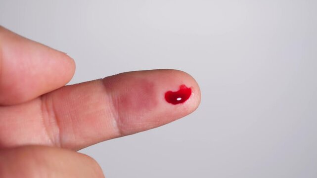 A light-skinned finger has a small puncture wound on its tip, from which a single, bright red drop of blood has emerged. The blood sits visibly against the plain white background.
