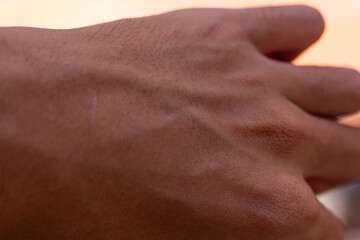 Fototapeta premium Close-up of human hand back with visible veins, skin texture, and a small scar.