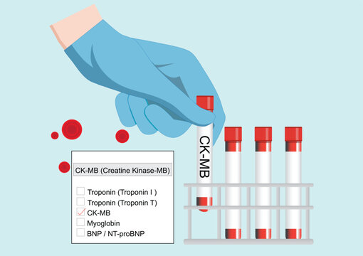 CK MB levels can help identify a reinfarction shortly after the first heart attack.