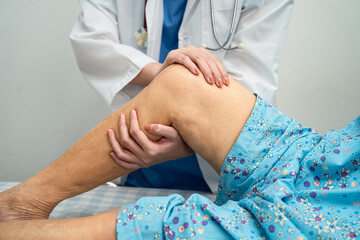Doctor checking Asian elderly woman patient knee replacement surgery in hospital.