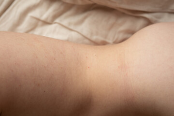 High-resolution image showing detailed skin texture.  Perfect for medical, beauty, or skincare.