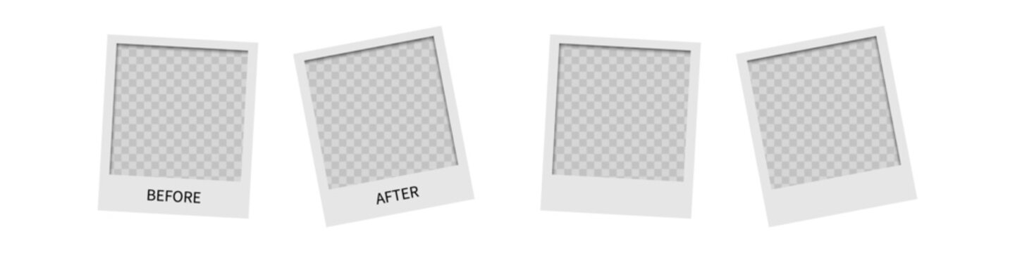 Template background before and after. Before and after photo frame. Comparison banner with empty space. Vector illustration