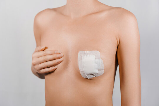 Patient covering breast with hand after tumor removal surgery, showing large adhesive bandage on clean skin in a close-up medical concept image