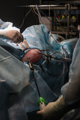 Veterinary surgeons performing laparoscopic surgery with specialized instruments in a sterile operating room, emphasizing precision and minimally invasive techniques for animal care.