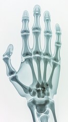 Naklejka premium High resolution X-ray image of a human hand highlighting the detailed bone structure with emphasis on a specific area showing signs of pain or inflammation in the wrist and fingers.