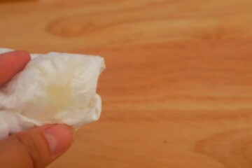 White tissue containing female cervical mucus, a sign of vaginal discharge, close up view.