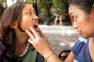 Asian mother checking on the inside of her teenage daughter's mouth, examining her oral hygiene and dental health during lunch time at an outdoor restaurant.