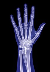 X-Ray Image of Human Hand Bones