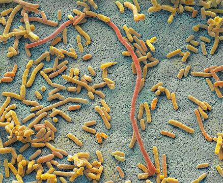 Dishcloth bacteria, SEM