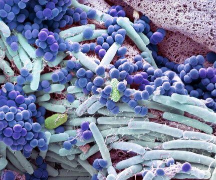 Skin bacteria, SEM