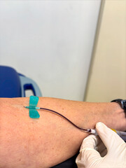Arm of a patient whose blood is being drawn by a nurse.