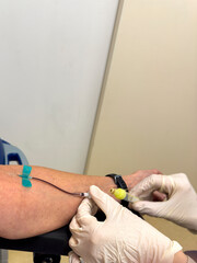 Arm of a patient whose blood is being drawn by a nurse.