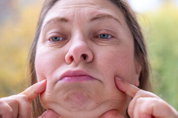 Double chin face mature woman 50 years old, human fat neck, wrinkles on skin, facelift, age-related skin changes, aesthetic injection cosmetology, care anti-aging procedures
