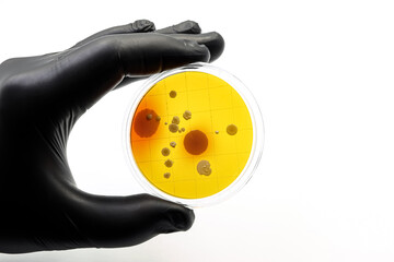 Microbiology. Superbugs. Antibiotics. Black nitrile glove with a culture of bacteria.
