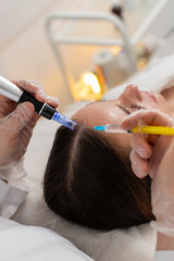 Alopecia. Caucasian girl receives targeted scalp therapy with dermapen and vitamin injection to...