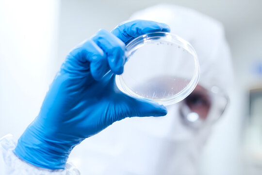 Sterile gloved hand holding petri dish with microbial cultures in a laboratory setting