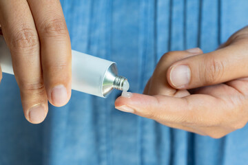 Man's hand. Apply topical steroids. Pain relief from muscle inflammation, medical concept.	
