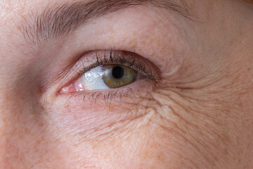 Cropped eye with wrinkles of middle aged caucasian woman smiling and looking at camera