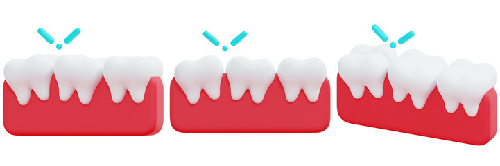 Set of Illustration of Misaligned Teeth 3d Render Icon Illustration