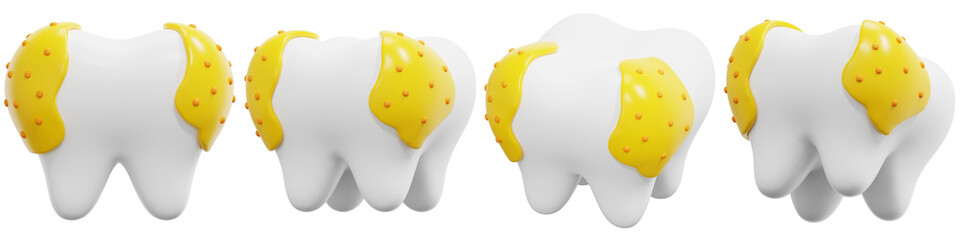 Set of Multiple Teeth with Yellow Caries Spots 3d Render Icon Illustration