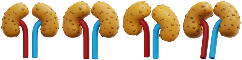 Set of Polycystic Kidneys 3d Render Icon Illustration