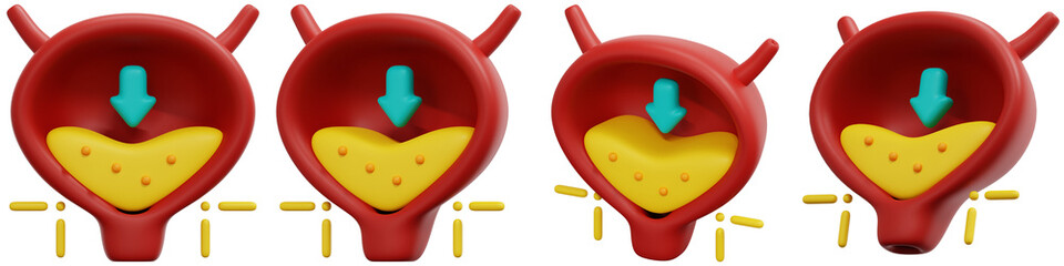 Set of Urinary Bladder with Inflowing Yellow Fluid, Medical Illustration 3d Render Icon Illustration