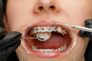 Orthodontic examination with dental mirror and tool