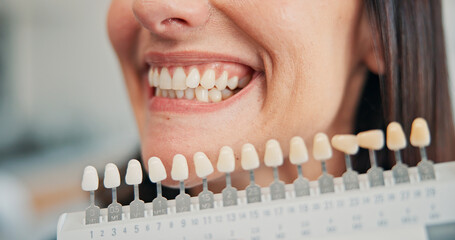 Decision, implant and teeth of woman at dentist for oral procedure or surgery closeup. Choice,...