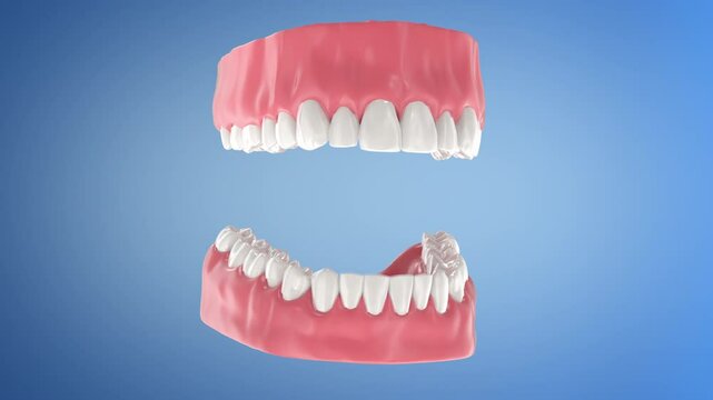 Close-up of brown teeth whitening with invisible tray. Whitening tray is removed after color changes to white. Ideal for cosmetic dental visuals.