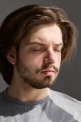 Obraz premium a man with a slight redness on his skin. A real photo of people