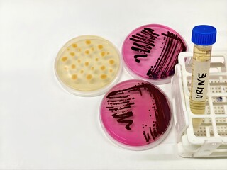 Microbiological culture plates in the clinical laboratory, next to a urine sample.