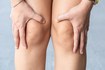 Woman with knee pain, he puts his hand on his knee, pain point from osteoarthritis and...