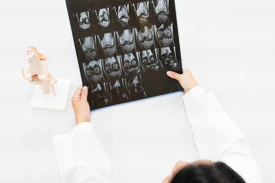 Doctor holding patient bone x-ray film before surgery.Image MRI and CT scan at radiology orthopedic department in hospital.Knee join injury for treatment.Physiotherapy teach model for injured athlete.