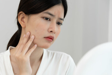 Woman worried about face Dermatology, rosacea dermatitis, allergic steroids, sensitive skin, red...