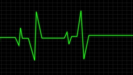Naklejka premium A green heartbeat monitor line showing a flatline after a period of cardiac activity signaling the end of life or death