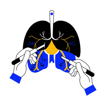 A doodle style illustration showing lungs surgery
