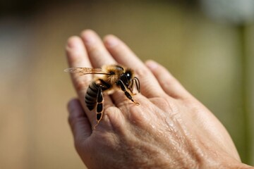 Obraz premium Bee sitting on swollen hand after sting outdoors in natural light 