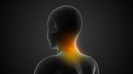 Cervical Postural Strain Leading to Neck Discomfort