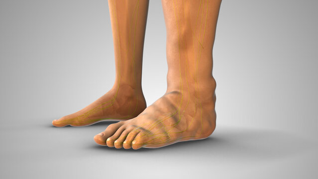 Fluid Retention Causing Pitting Edema