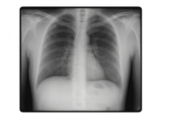 Radiography image of healthy human thorax, revealing normal heart and lung structures, isolated on transparent background