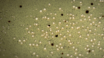 Microscopic view of tiny, pale, round objects scattered on a muted olive-green surface