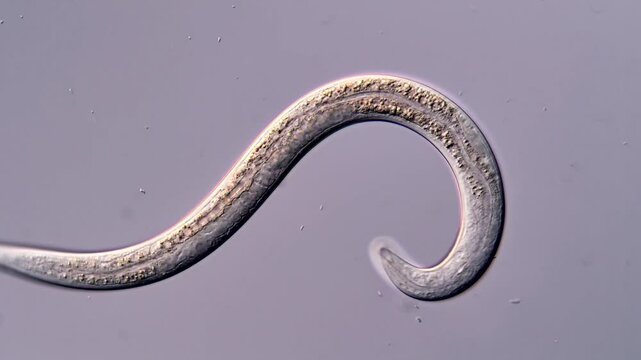 Movement of nematode larvae under microscope, 400x