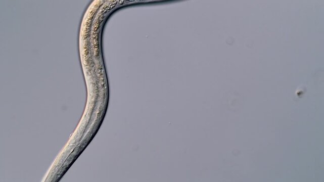 Movement of freshwater worm under microscope view,  400x