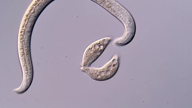 Movement of Dileptus couble and nematode larvae DIC microscope view 