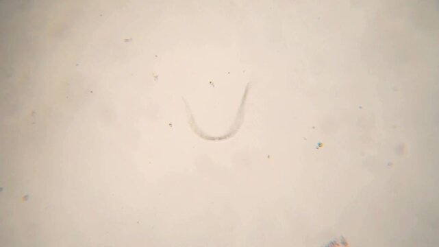 A moving nematode under a microscope.	