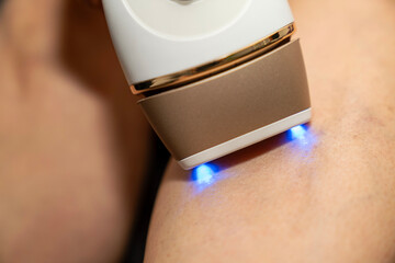 Female hand using IPL laser hair removal device on leg at home. beauty, skincare, smooth skin, permanent hair removal, self care, personal grooming, painless treatment,  beauty center  routine. © ATRPhoto